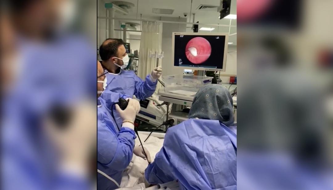 Yedikken ölümle öldü! Sarımsak ciğerlerinden kaçtı! 4
